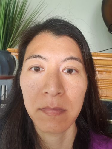 After PRP Facial